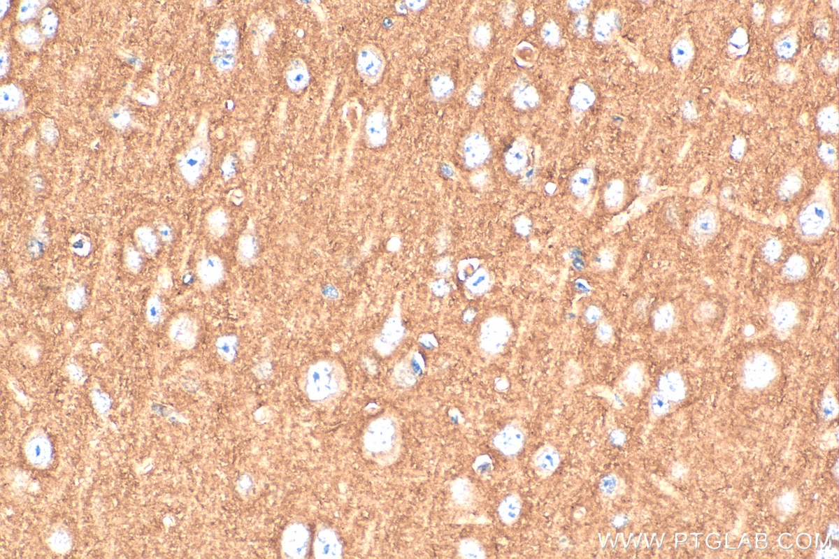 Immunohistochemistry (IHC) staining of mouse brain tissue using CNTN1 Polyclonal antibody (13843-1-AP)