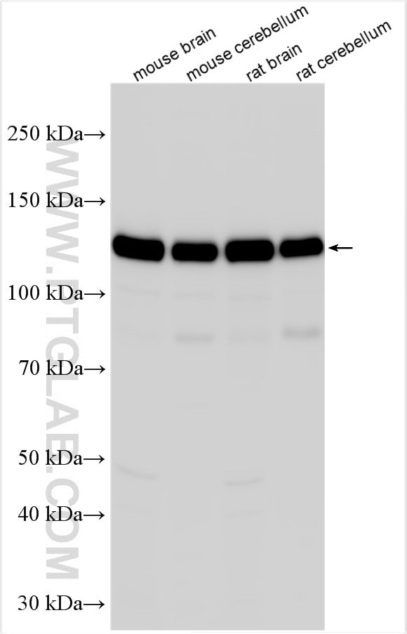 Western Blot (WB) analysis of various lysates using CNTN1 Polyclonal antibody (13843-1-AP)
