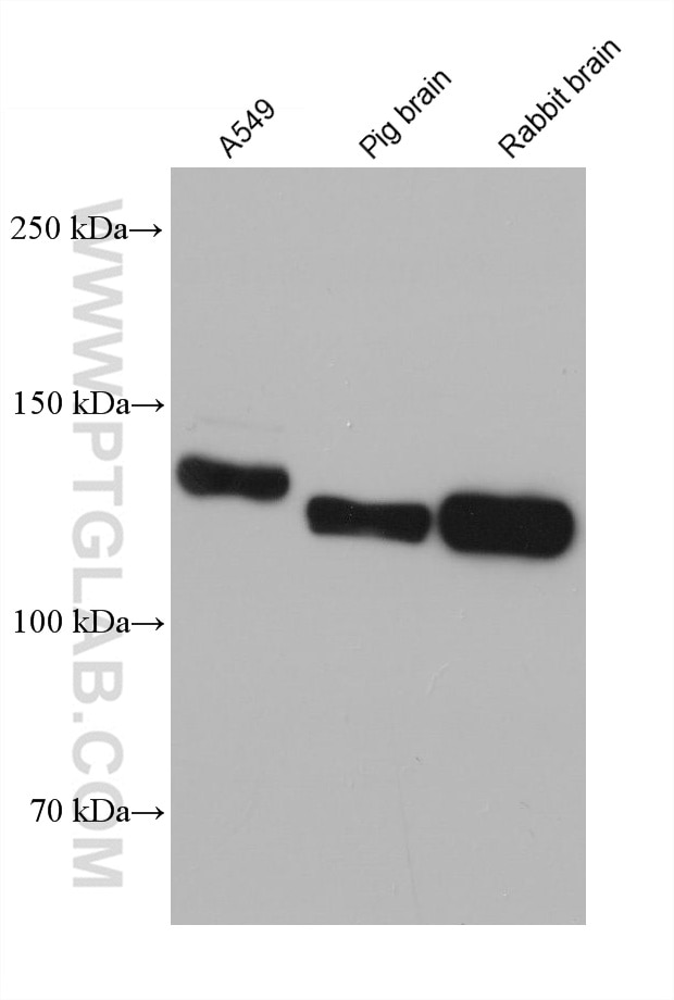 Western Blot (WB) analysis of various lysates using CNTN1 Monoclonal antibody (68252-1-Ig)