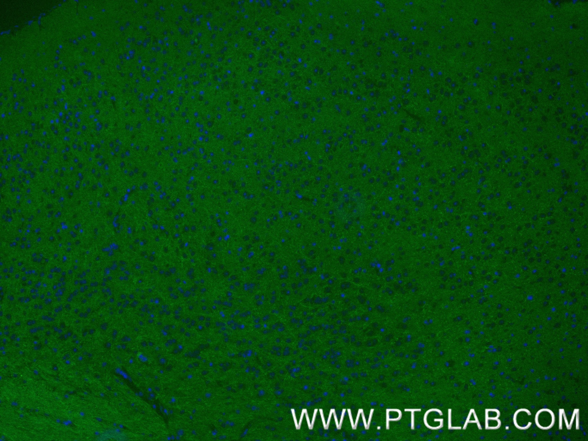 IF Staining of mouse brain using 87612-1-RR Immunofluorescence (IF) / fluorescent staining of mouse brain tissue using CNTN1 Recombinant monoclonal antibody (87612-1-RR)