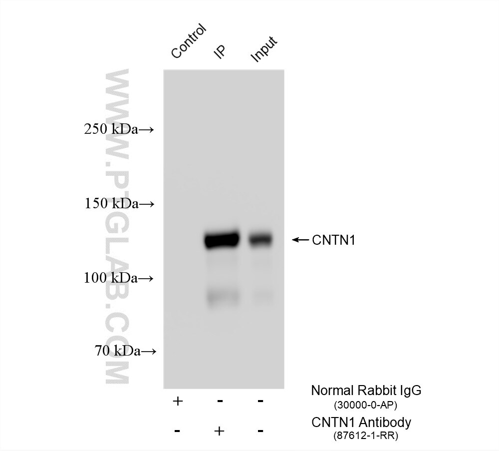 IP result of anti-CNTN1 (IP:87612-1-RR, 4 ug; Detection: 87612-1-RR 1:5000) with rat brain tissue lysate 1720 ug. Immunoprecipitation (IP) experiment of rat brain tissue using CNTN1 Recombinant monoclonal antibody (87612-1-RR)