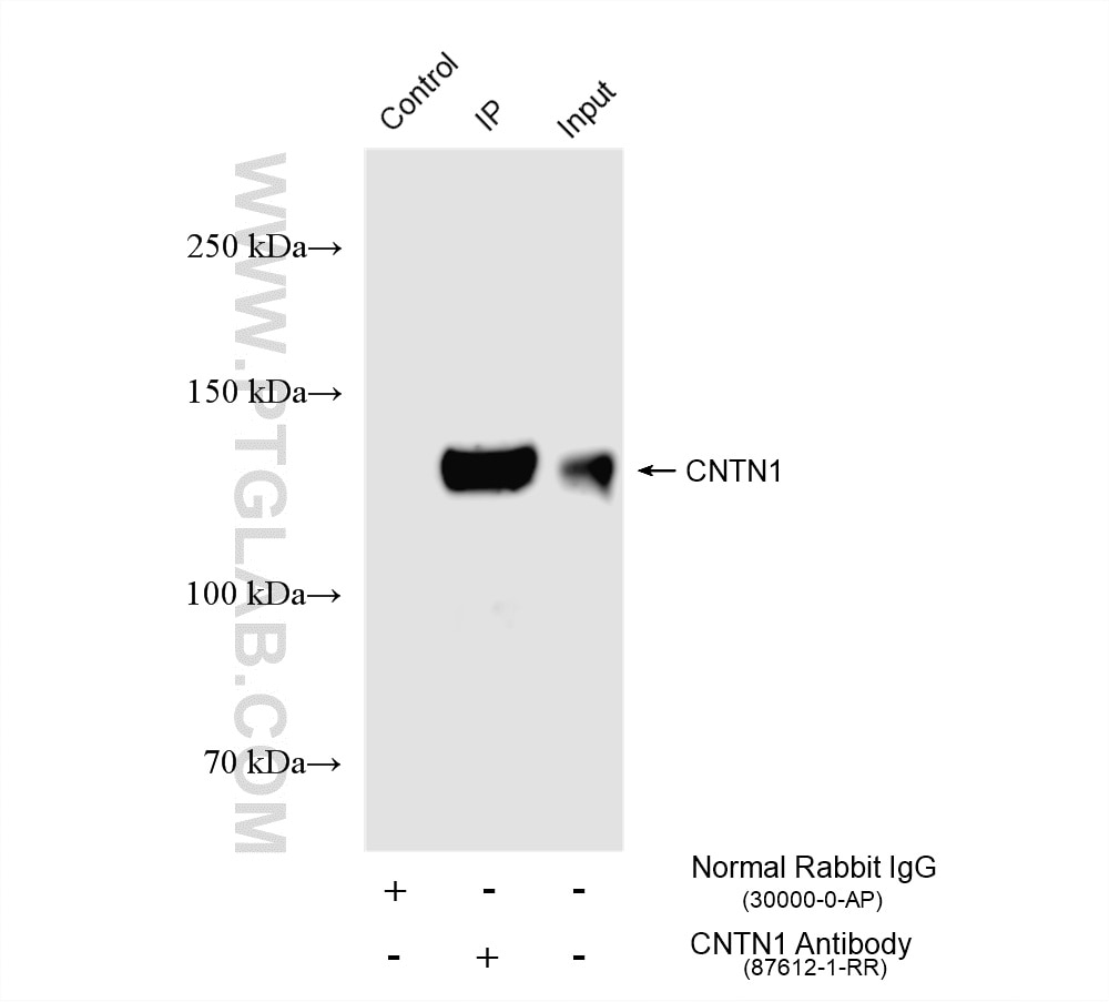 IP experiment of rat brain using 87612-1-RR (same clone as 87612-1-PBS) Immunoprecipitation (IP) experiment of rat brain tissue using CNTN1 Recombinant monoclonal antibody (87612-1-RR)