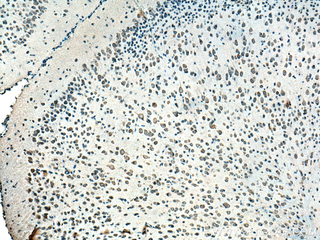 Immunohistochemistry (IHC) staining of mouse brain tissue using CNTN2 Monoclonal antibody (67089-1-Ig)