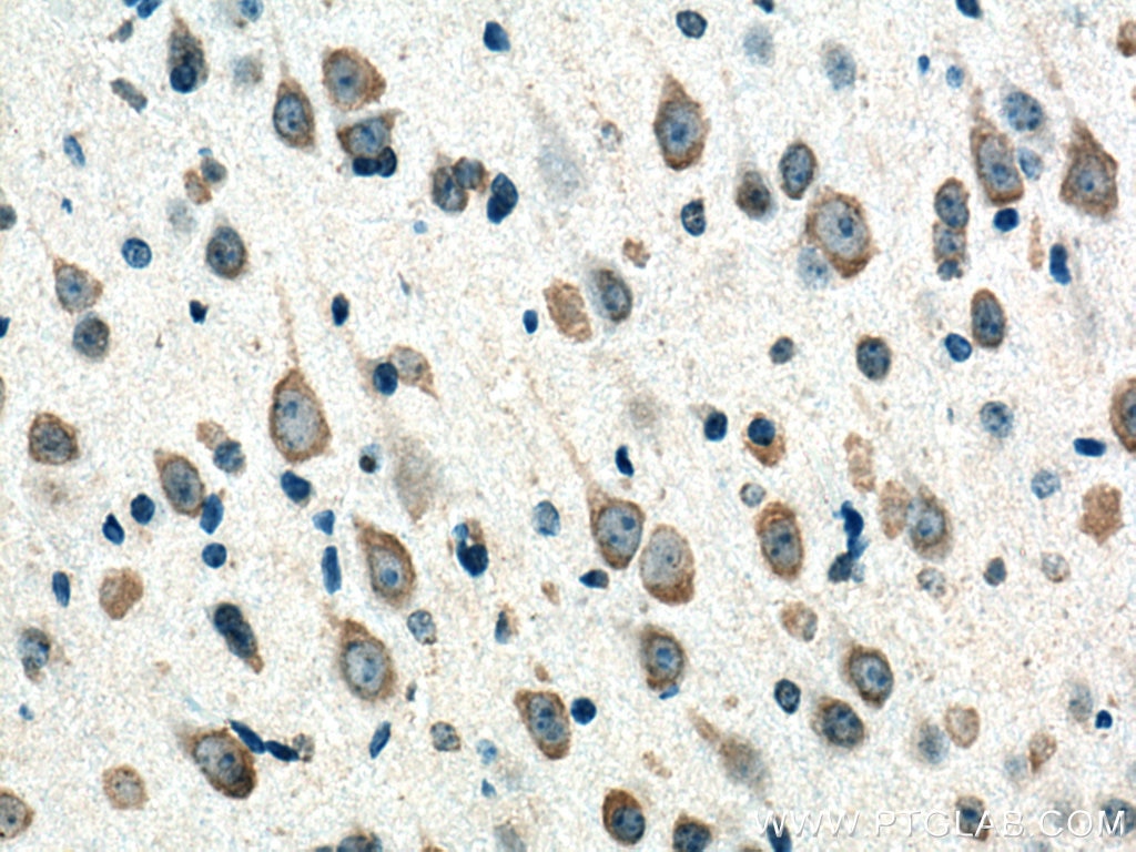 Immunohistochemistry (IHC) staining of mouse brain tissue using CNTN2 Monoclonal antibody (67089-1-Ig)