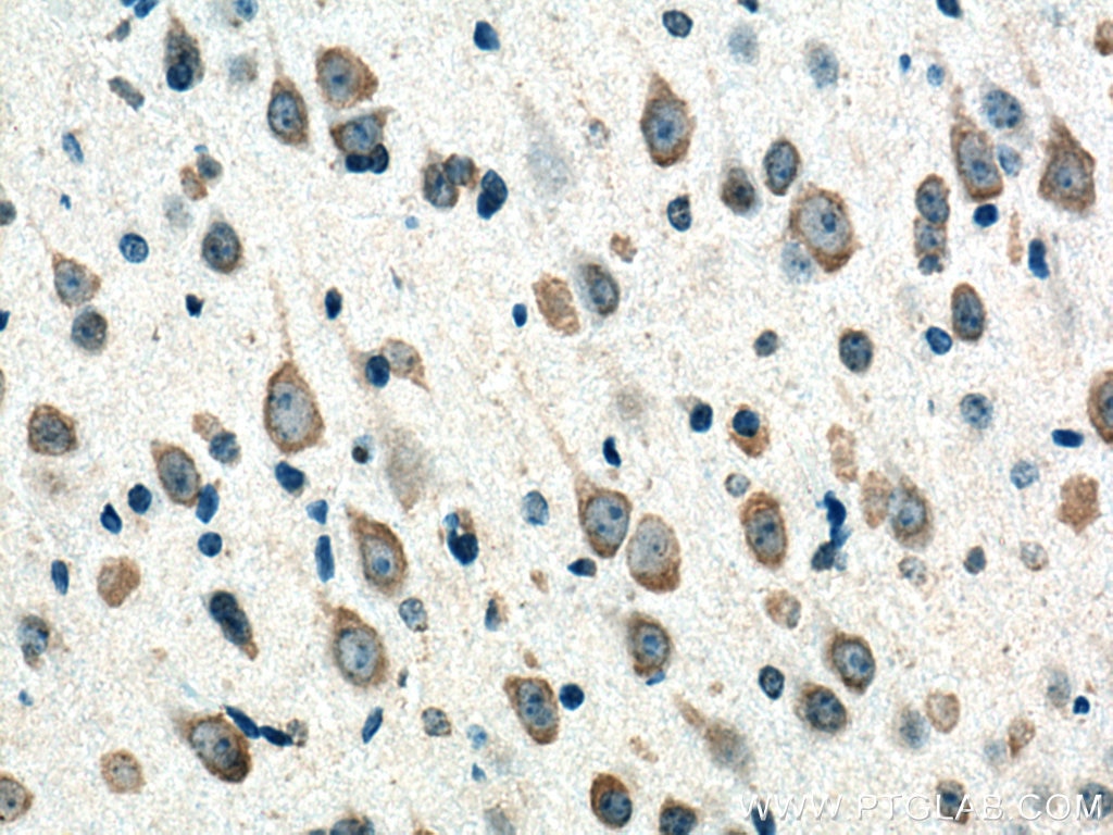 IHC staining of mouse brain using 67089-1-Ig