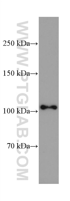 WB analysis of pig spinal cord using 67089-1-Ig