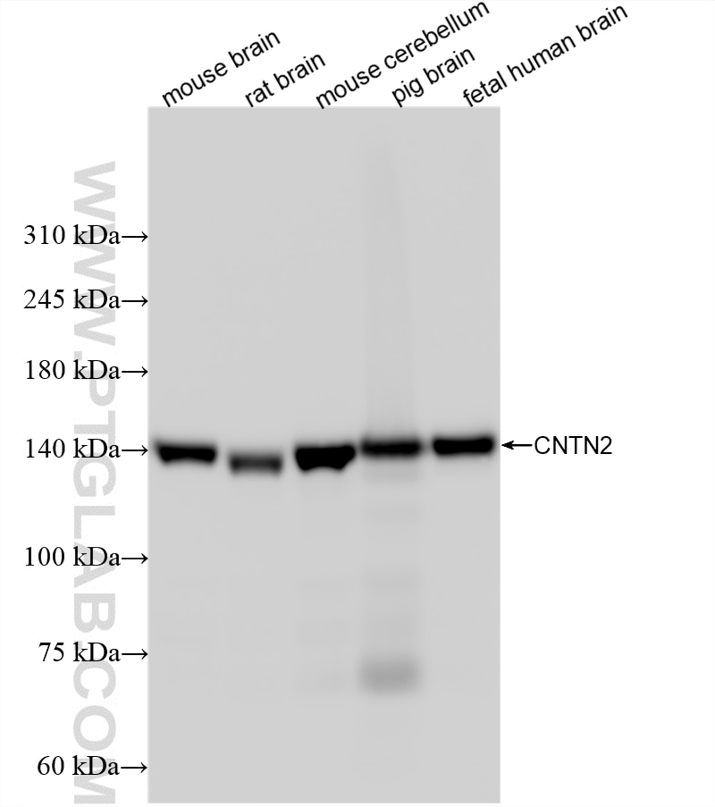 Western Blot (WB) analysis of various lysates using CNTN2 Recombinant monoclonal antibody (87574-1-RR)