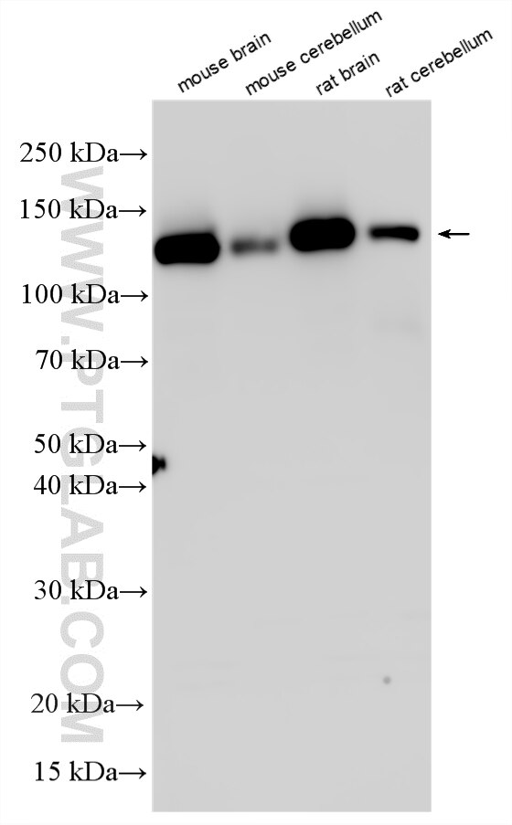 WB analysis using 33720-1-AP Western Blot (WB) analysis of various lysates using CNTN3 Polyclonal antibody (33720-1-AP)