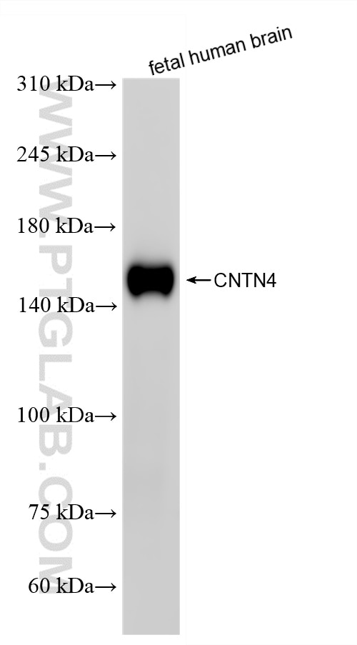 WB analysis of fetal human brain using 87572-1-RR (same clone as 87572-1-PBS) Western Blot (WB) analysis of fetal human brain tissue using CNTN4 Recombinant monoclonal antibody (87572-1-RR)
