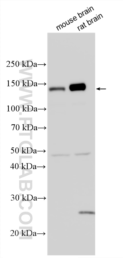WB analysis using 33610-1-AP Western Blot (WB) analysis of various lysates using CNTN5 Polyclonal antibody (33610-1-AP)