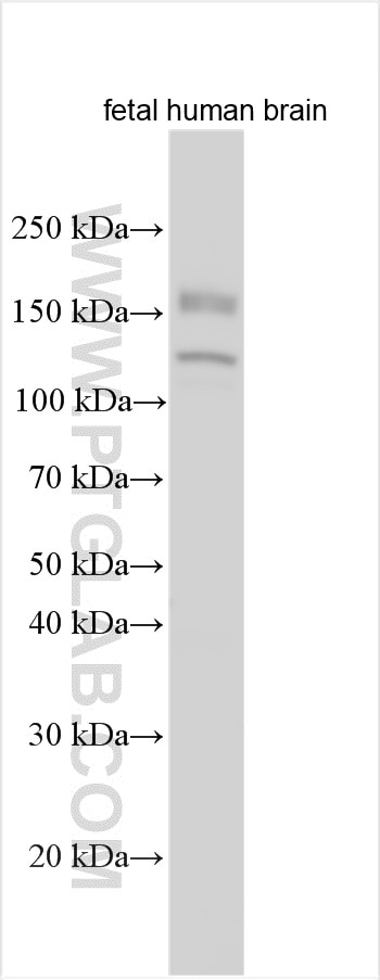 Western Blot (WB) analysis of various lysates using CNTNAP4 Polyclonal antibody (32250-1-AP)