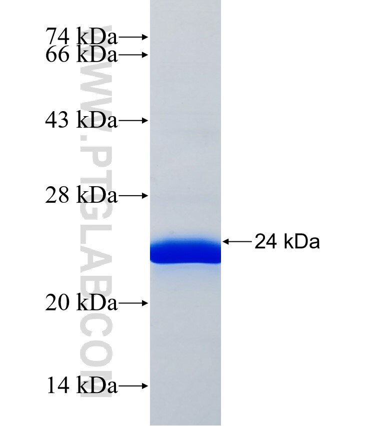 CNTNAP4 fusion protein Ag37558 SDS-PAGE CNTNAP4 fusion protein Ag37558 SDS-PAGE