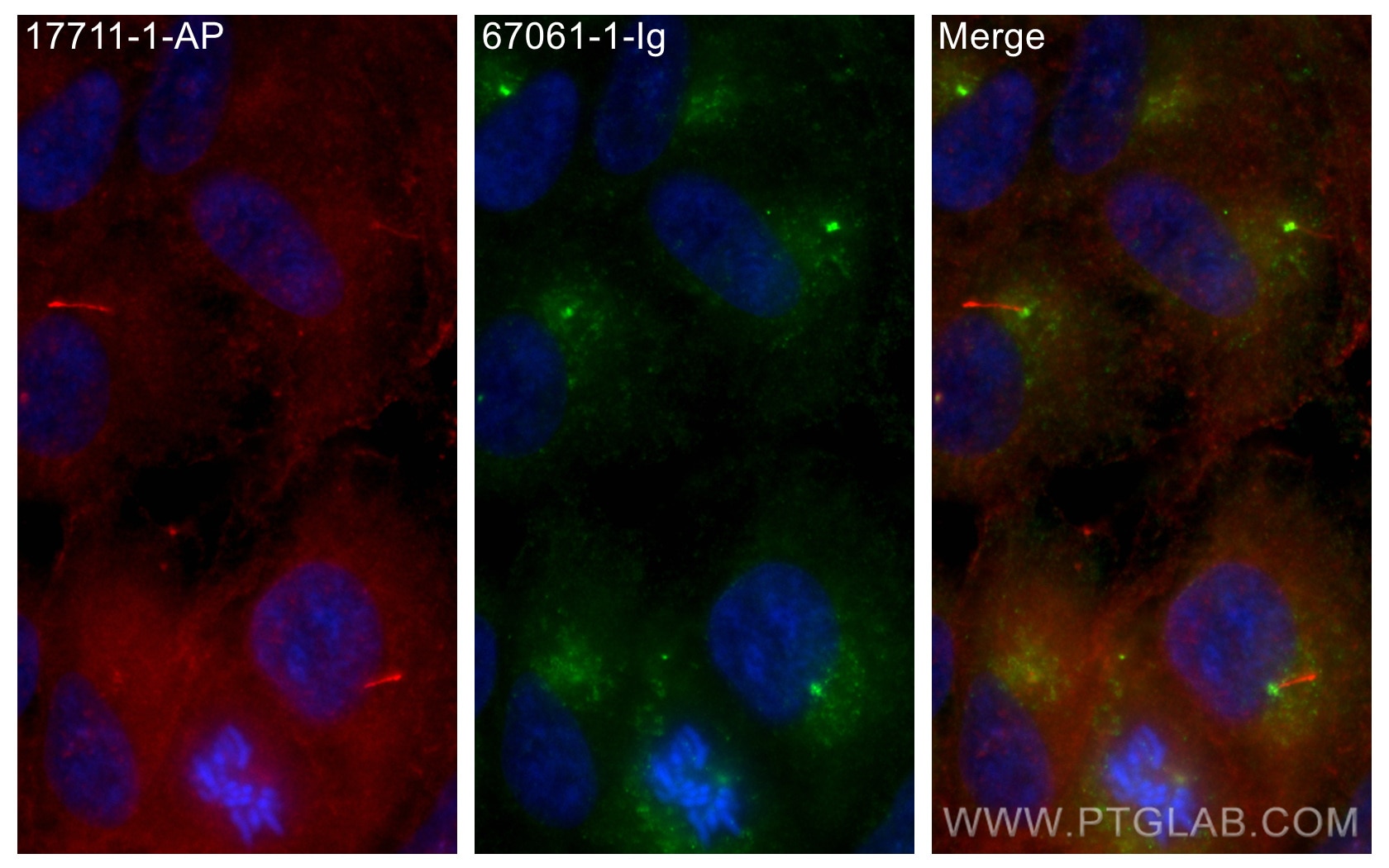 Immunofluorescence (IF) / fluorescent staining of hTERT-RPE1 cells using CNTROB Monoclonal antibody (67061-1-Ig)