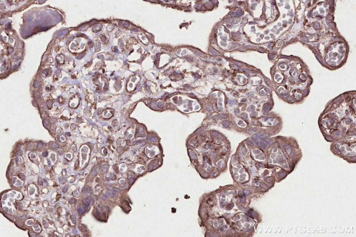IHC staining of human placenta using 67061-1-Ig Immunohistochemistry (IHC) staining of human placenta tissue using CNTROB Monoclonal antibody (67061-1-Ig)