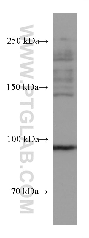 Western Blot (WB) analysis of rat brain tissue using CNTROB Monoclonal antibody (67061-1-Ig)