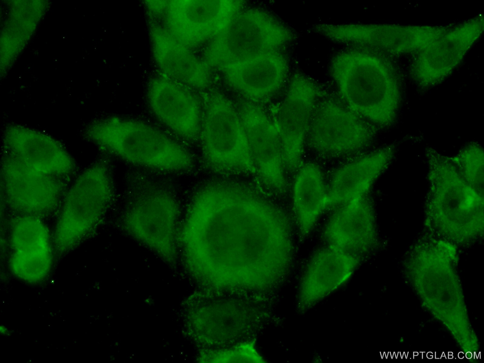 Immunofluorescence (IF) / fluorescent staining of HeLa cells using COASY Polyclonal antibody (12991-1-AP)