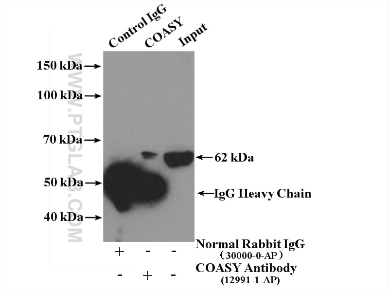 Immunoprecipitation (IP) experiment of HeLa cells using COASY Polyclonal antibody (12991-1-AP)