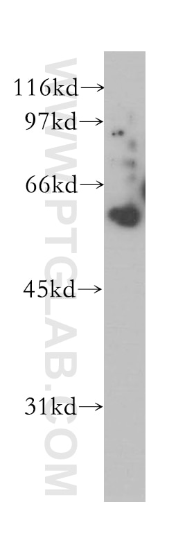 Western Blot (WB) analysis of HEK-293 cells using COASY Polyclonal antibody (12991-1-AP)