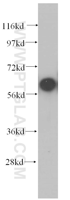 Western Blot (WB) analysis of HeLa cells using COASY Polyclonal antibody (12991-1-AP)