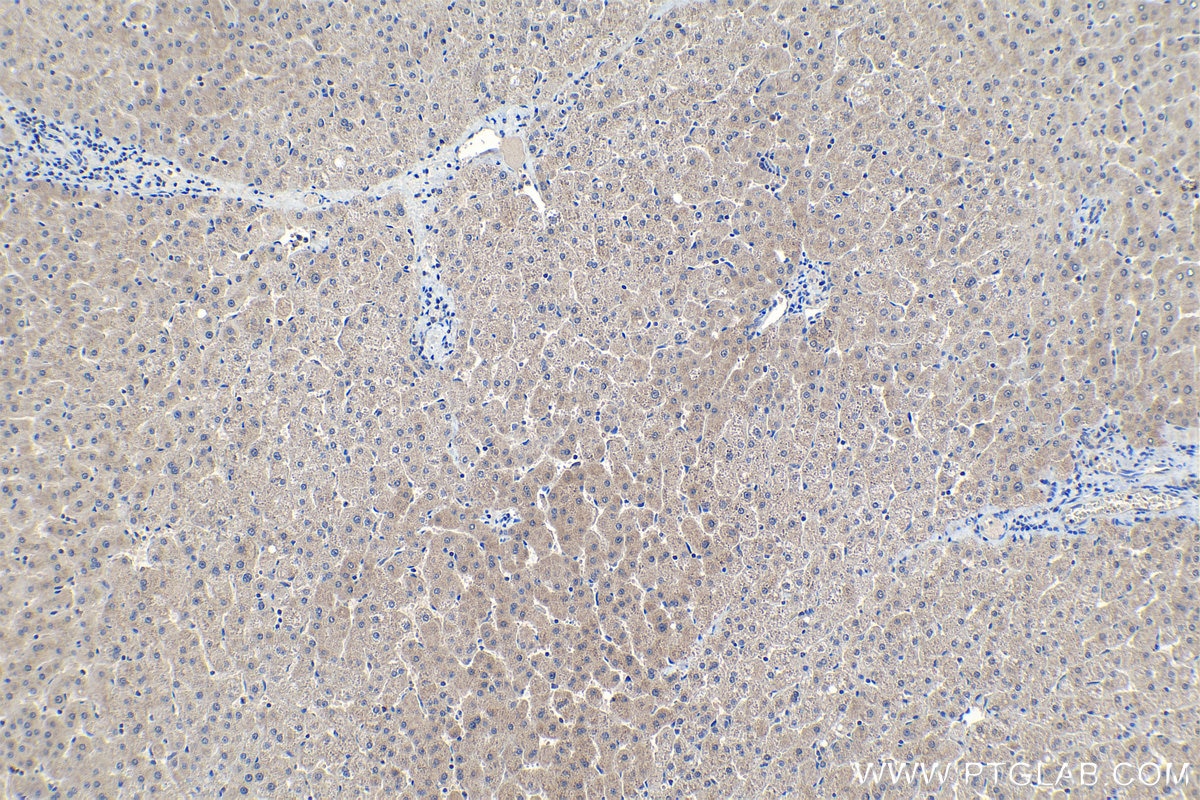 IHC staining of human liver using 68358-1-Ig