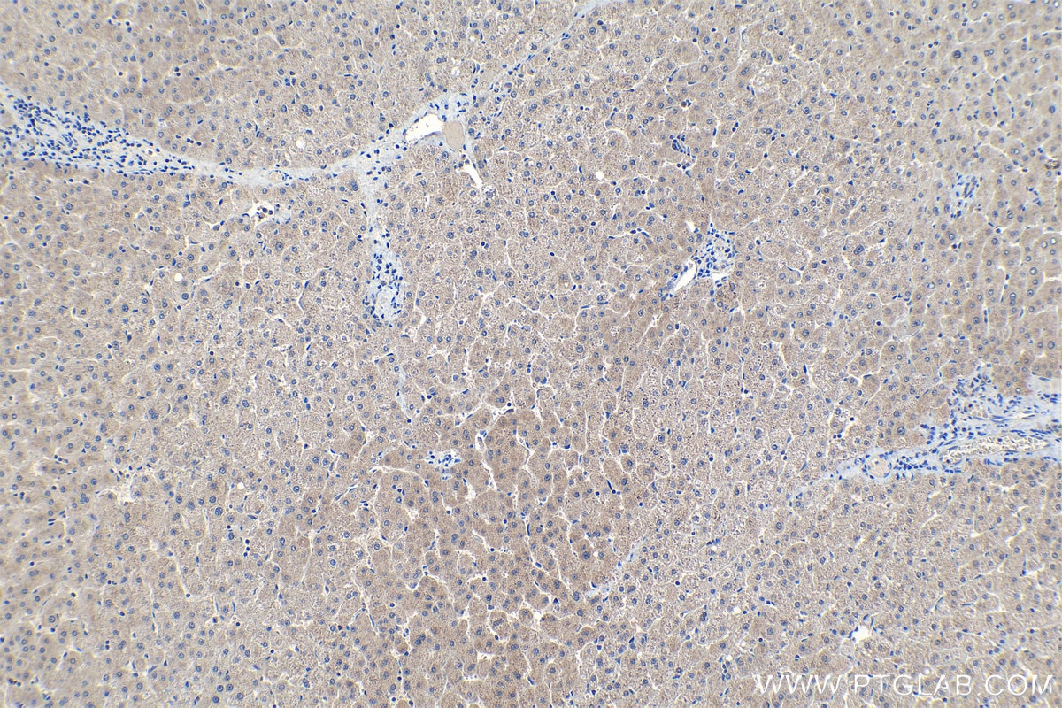 Immunohistochemistry (IHC) staining of human liver tissue using COASY Monoclonal antibody (68358-1-Ig)