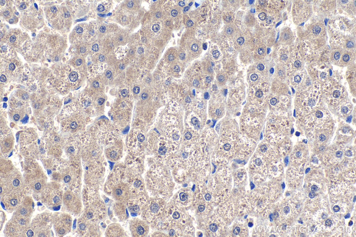 Immunohistochemistry (IHC) staining of human liver tissue using COASY Monoclonal antibody (68358-1-Ig)