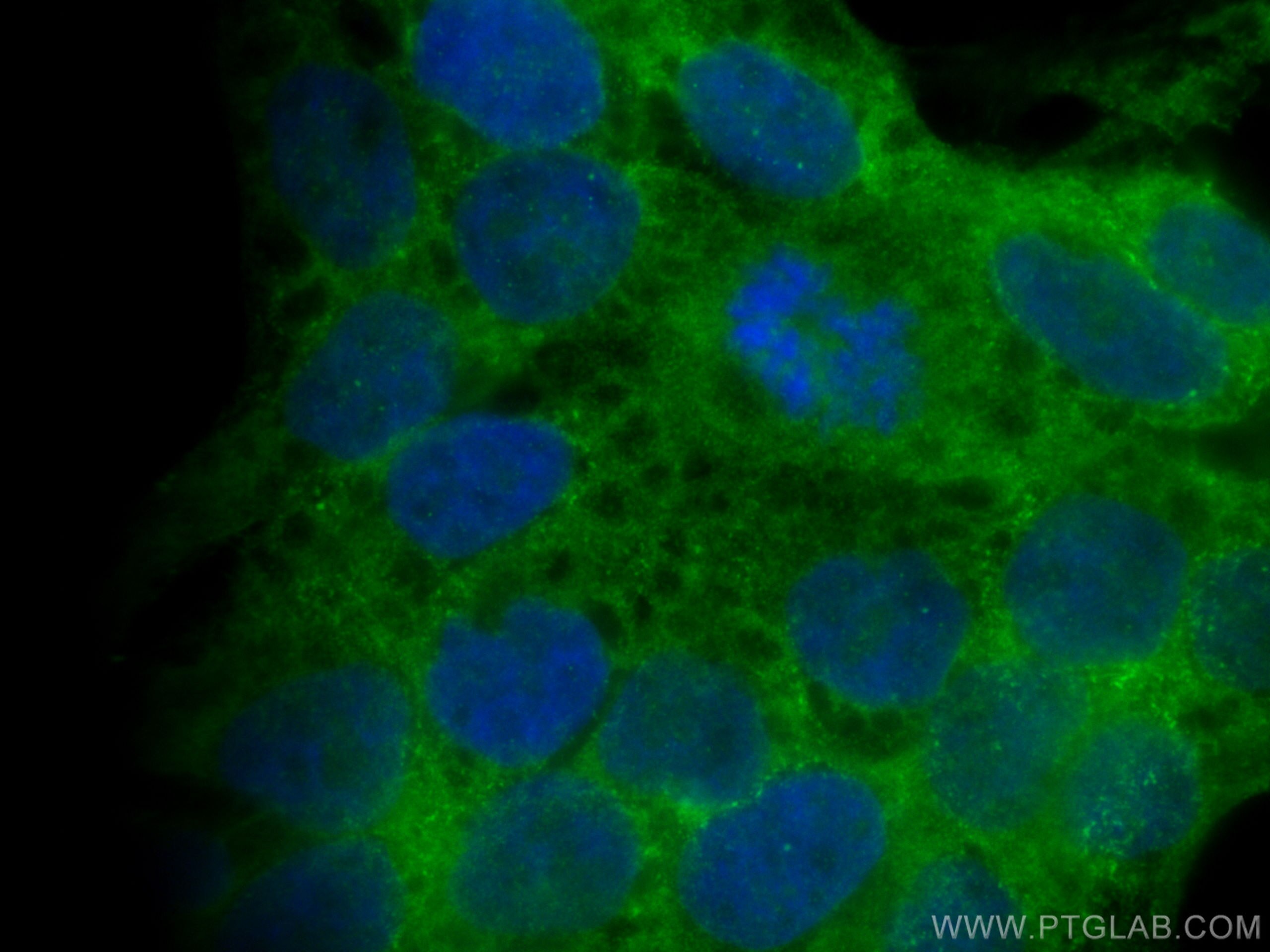 Immunofluorescence (IF) / fluorescent staining of HaCaT cells using COBLL1 Polyclonal antibody (31191-1-AP)