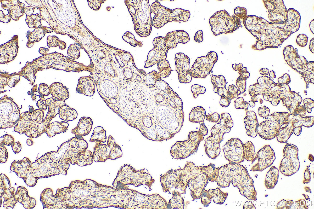 Immunohistochemistry (IHC) staining of human placenta tissue using COBLL1 Polyclonal antibody (31191-1-AP)