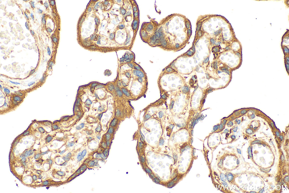 Immunohistochemistry (IHC) staining of human placenta tissue using COBLL1 Polyclonal antibody (31191-1-AP)