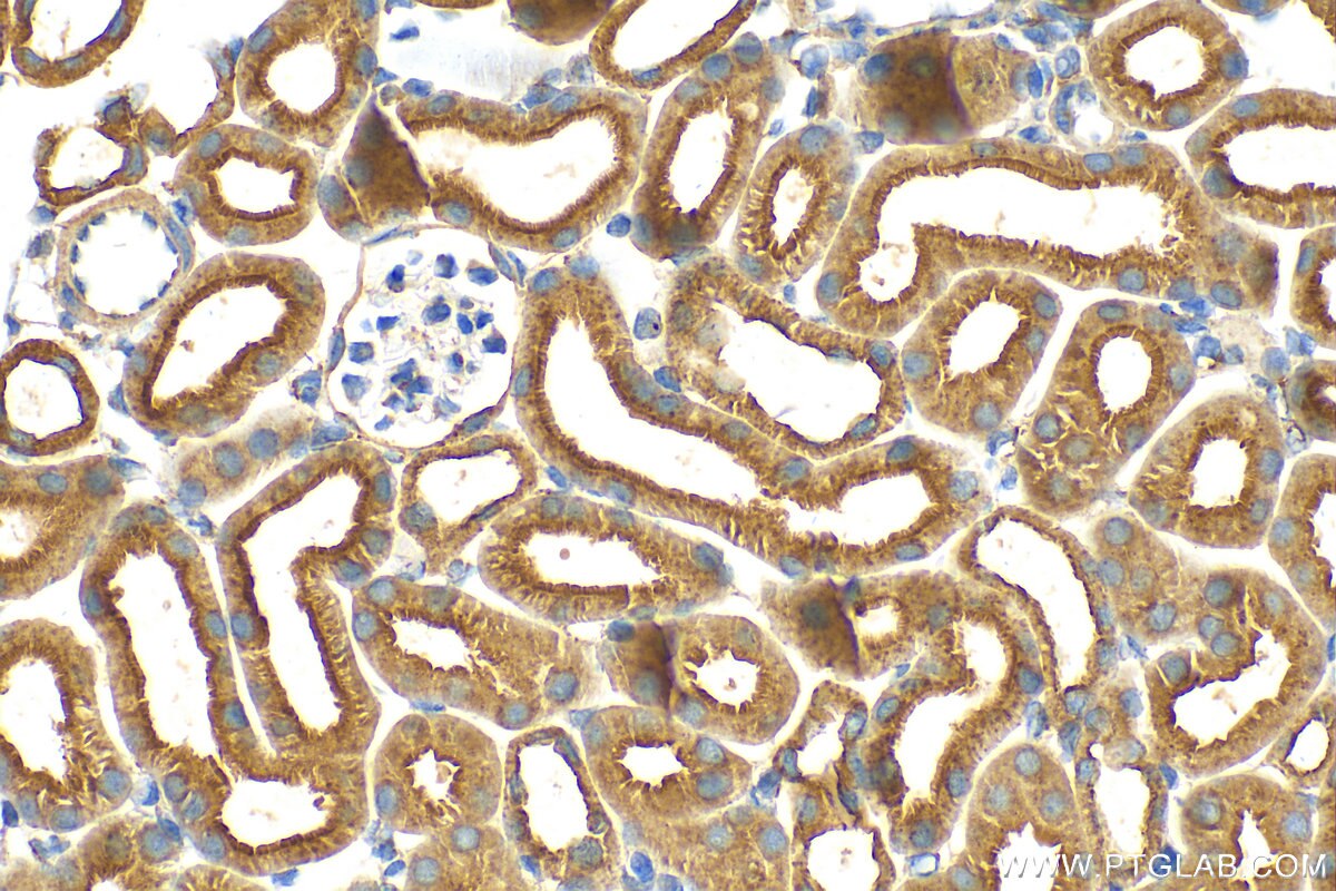Immunohistochemistry (IHC) staining of mouse kidney tissue using COBLL1 Polyclonal antibody (31191-1-AP)