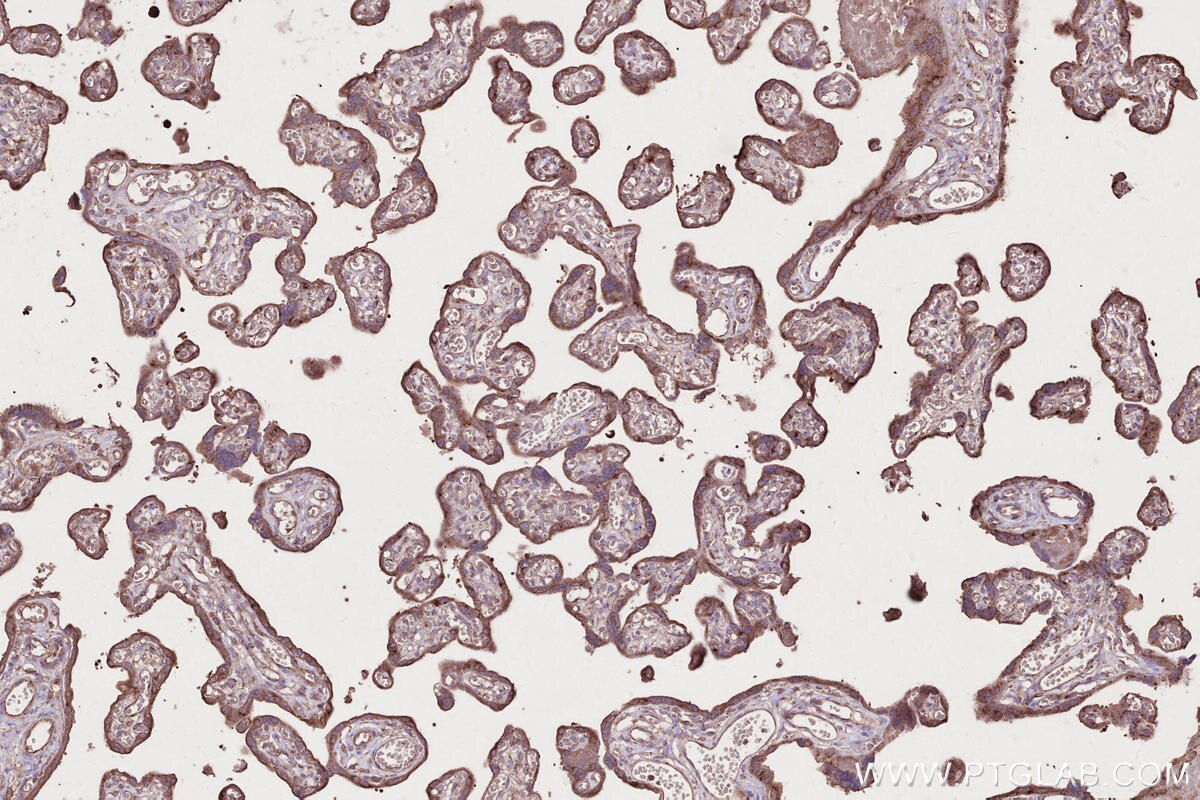 Immunohistochemistry (IHC) staining of human placenta tissue using COG1 Monoclonal antibody (68642-1-Ig)
