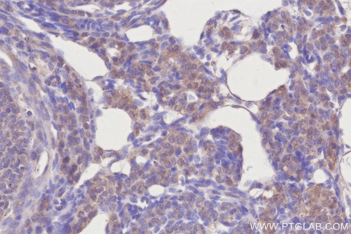 Immunohistochemistry (IHC) staining of mouse ovary tissue using COG1 Monoclonal antibody (68642-1-Ig)