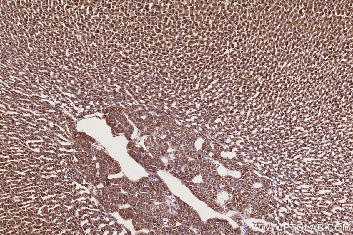Immunohistochemistry (IHC) staining of rat adrenal gland tissue using COG1 Monoclonal antibody (68642-1-Ig)