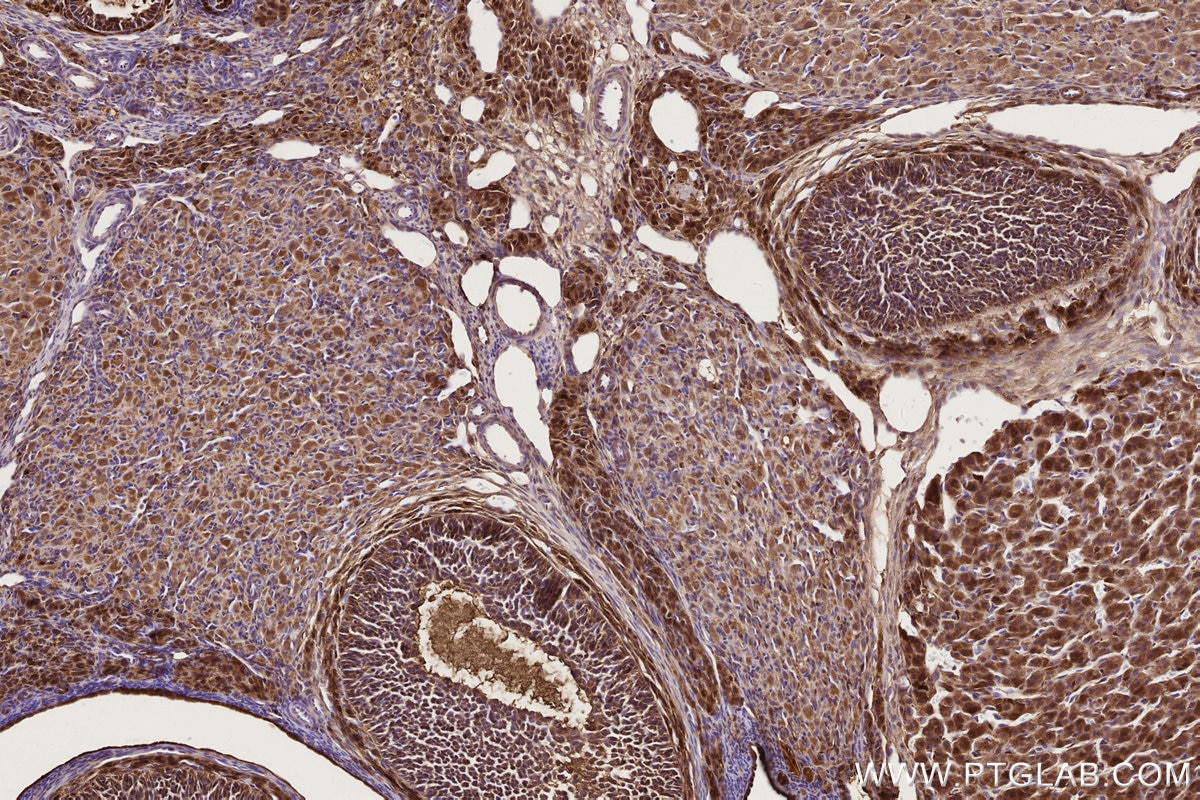 Immunohistochemistry (IHC) staining of rat ovary tissue using COG1 Monoclonal antibody (68642-1-Ig)