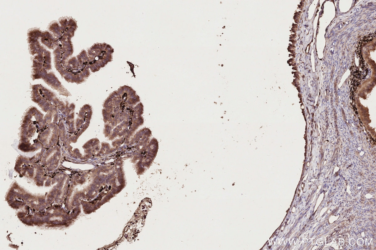 Immunohistochemistry (IHC) staining of rat ovary tissue using COG1 Monoclonal antibody (68642-1-Ig)