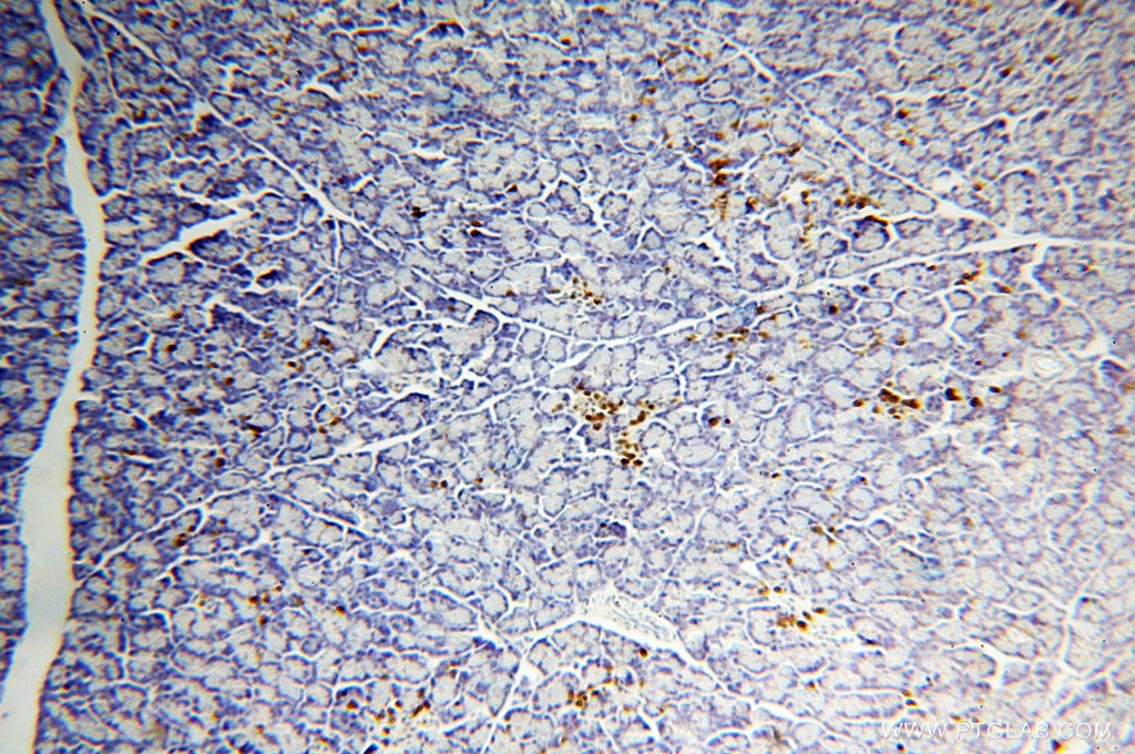 Immunohistochemistry (IHC) staining of human pancreas tissue using COG3 Polyclonal antibody (11130-1-AP)