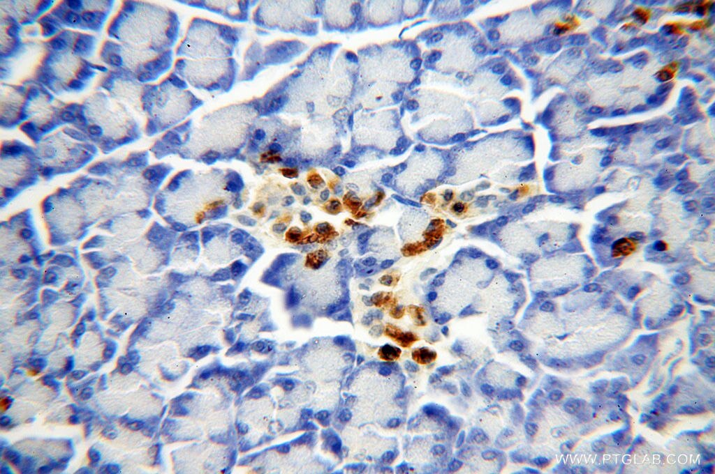 IHC staining of human pancreas using 11130-1-AP