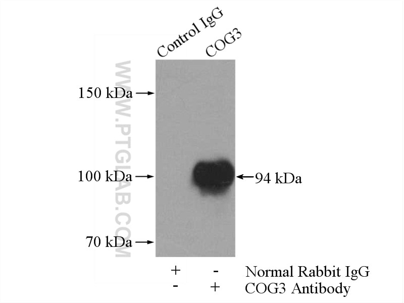 IP experiment of HeLa using 11130-1-AP