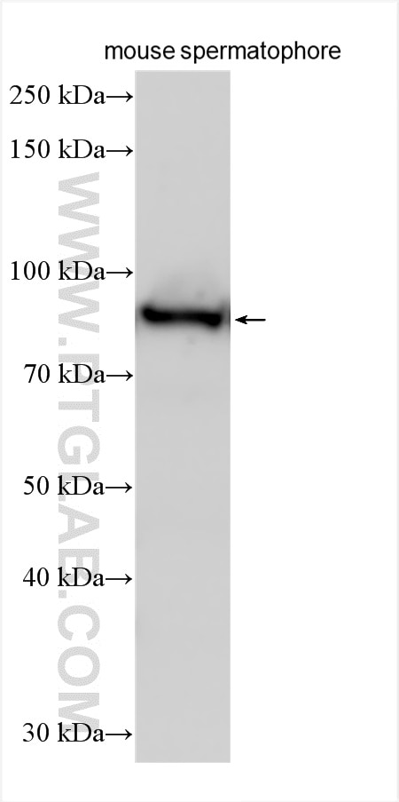 Western Blot (WB) analysis of various lysates using COG4 Polyclonal antibody (31539-1-AP)