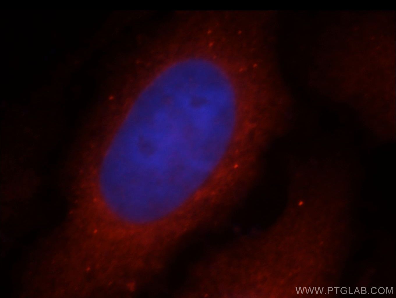 Immunofluorescence (IF) / fluorescent staining of MCF-7 cells using COG6 Polyclonal antibody (14277-1-AP)