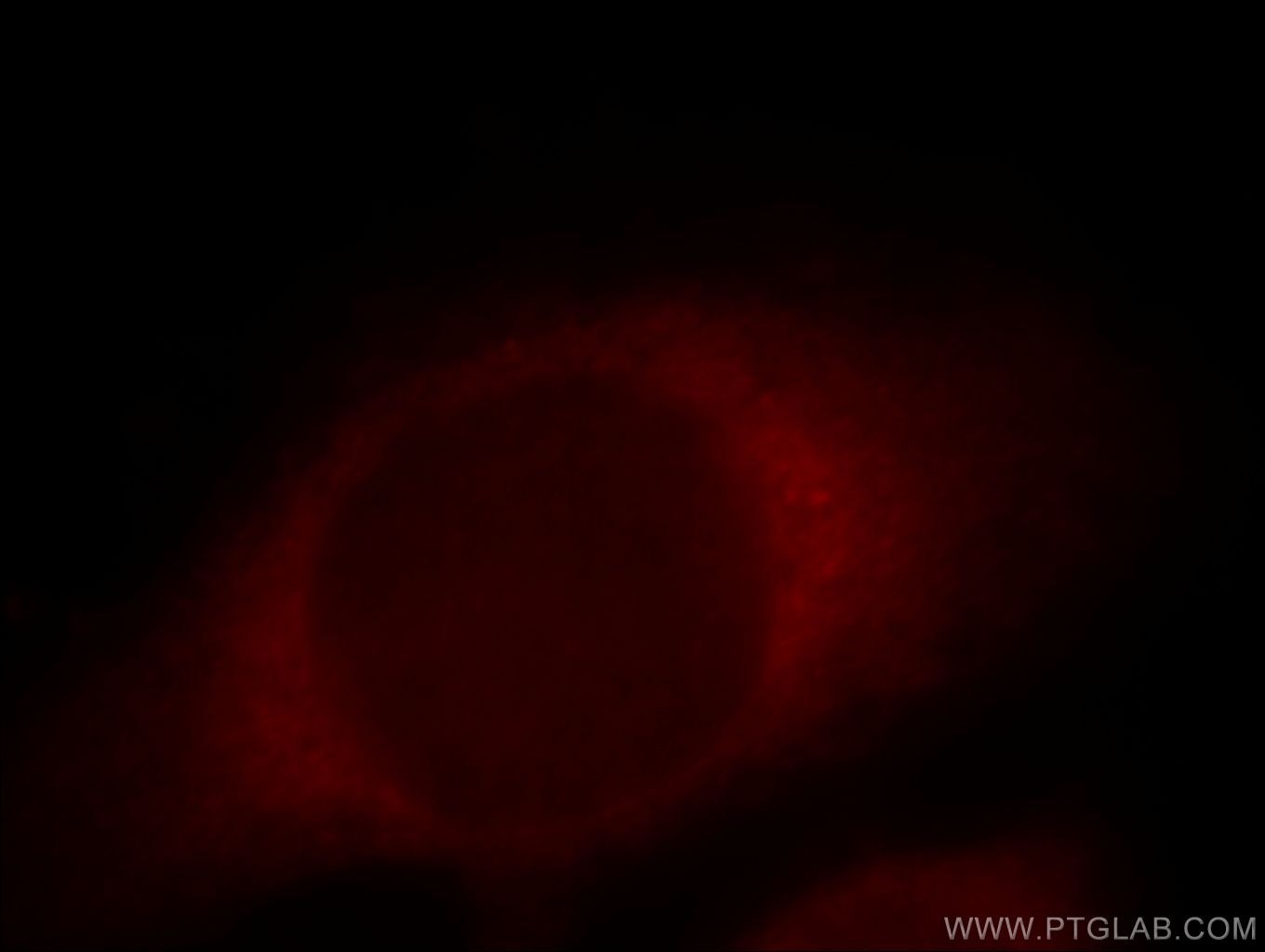 Immunofluorescence (IF) / fluorescent staining of HeLa cells using COG6 Polyclonal antibody (14277-1-AP)