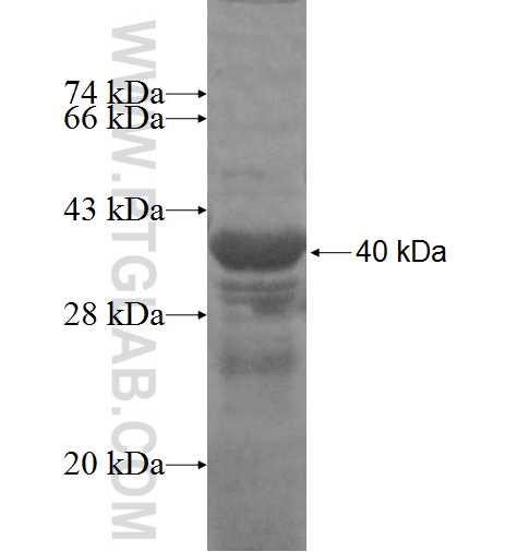COG6 fusion protein Ag5624 SDS-PAGE