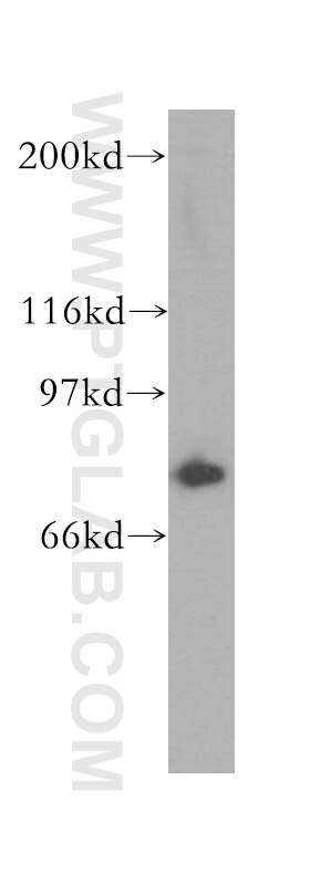 Western Blot (WB) analysis of Y79 cells using COG7 Polyclonal antibody (13552-1-AP)