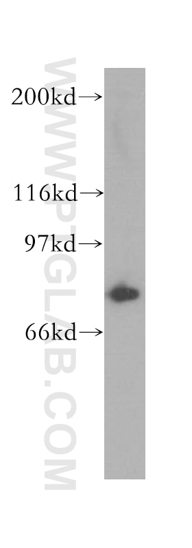 WB analysis of Y79 using 13552-1-AP