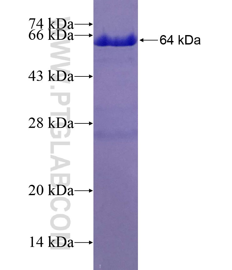 COG7 fusion protein Ag4335 SDS-PAGE