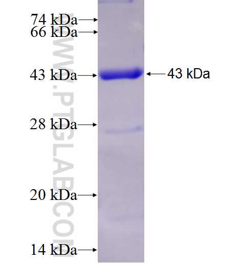COG7 fusion protein Ag5164 SDS-PAGE