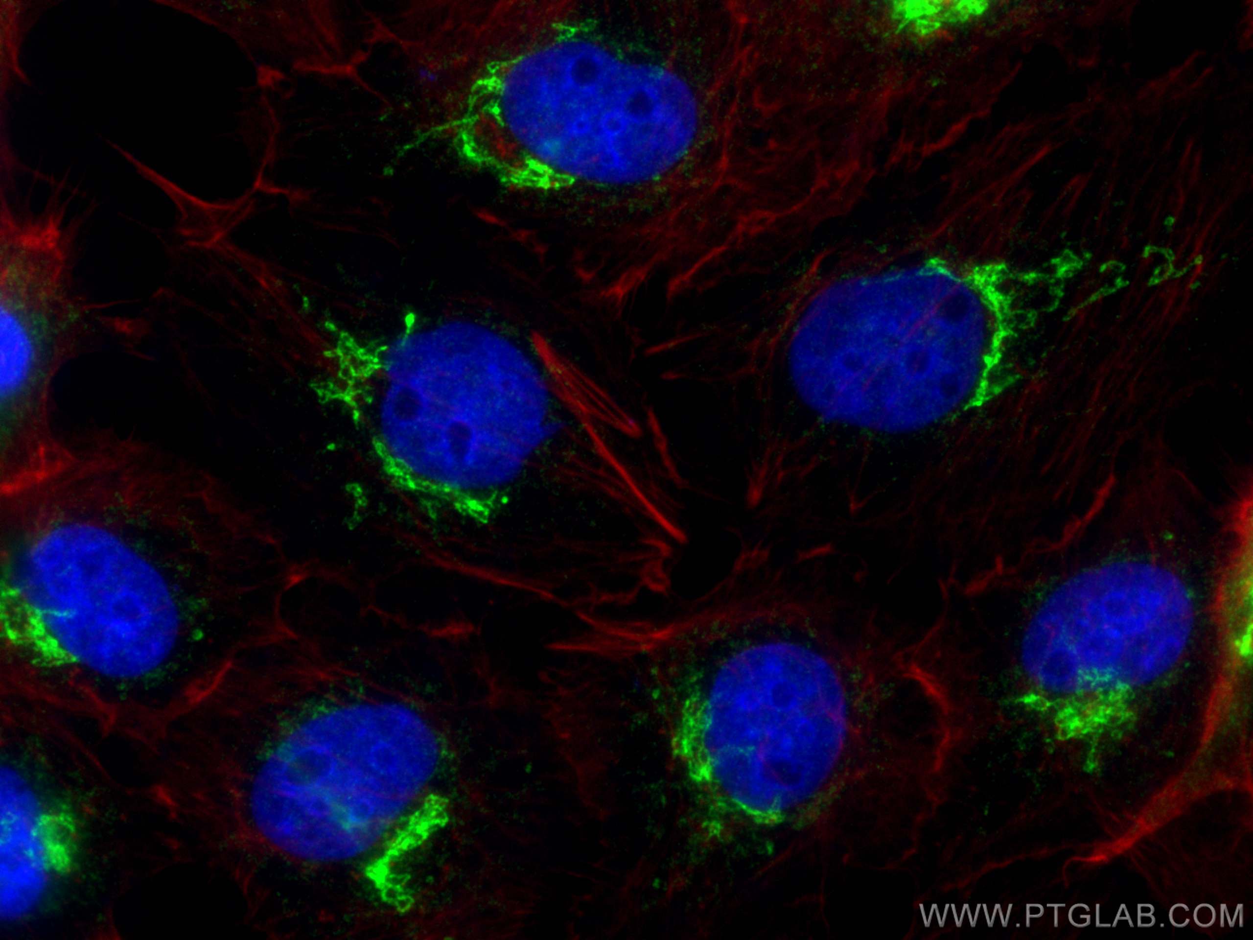 Immunofluorescence (IF) / fluorescent staining of A431 cells using COG8 Polyclonal antibody (12661-1-AP)