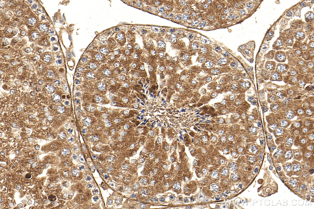 Immunohistochemistry (IHC) staining of mouse testis tissue using COG8 Polyclonal antibody (12661-1-AP)