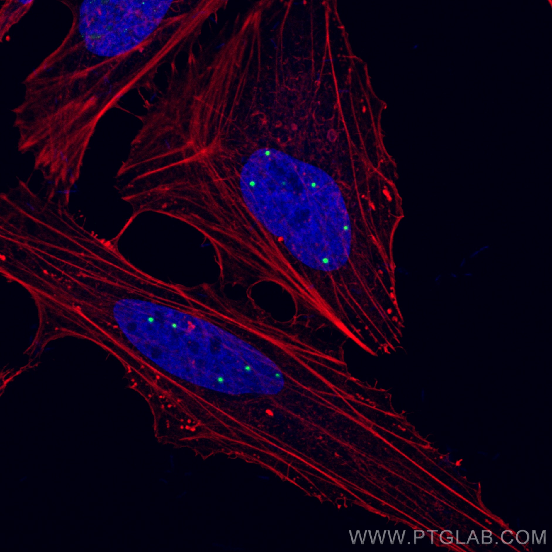 Immunofluorescence (IF) / fluorescent staining of HeLa cells using Coilin Polyclonal antibody (10967-1-AP)