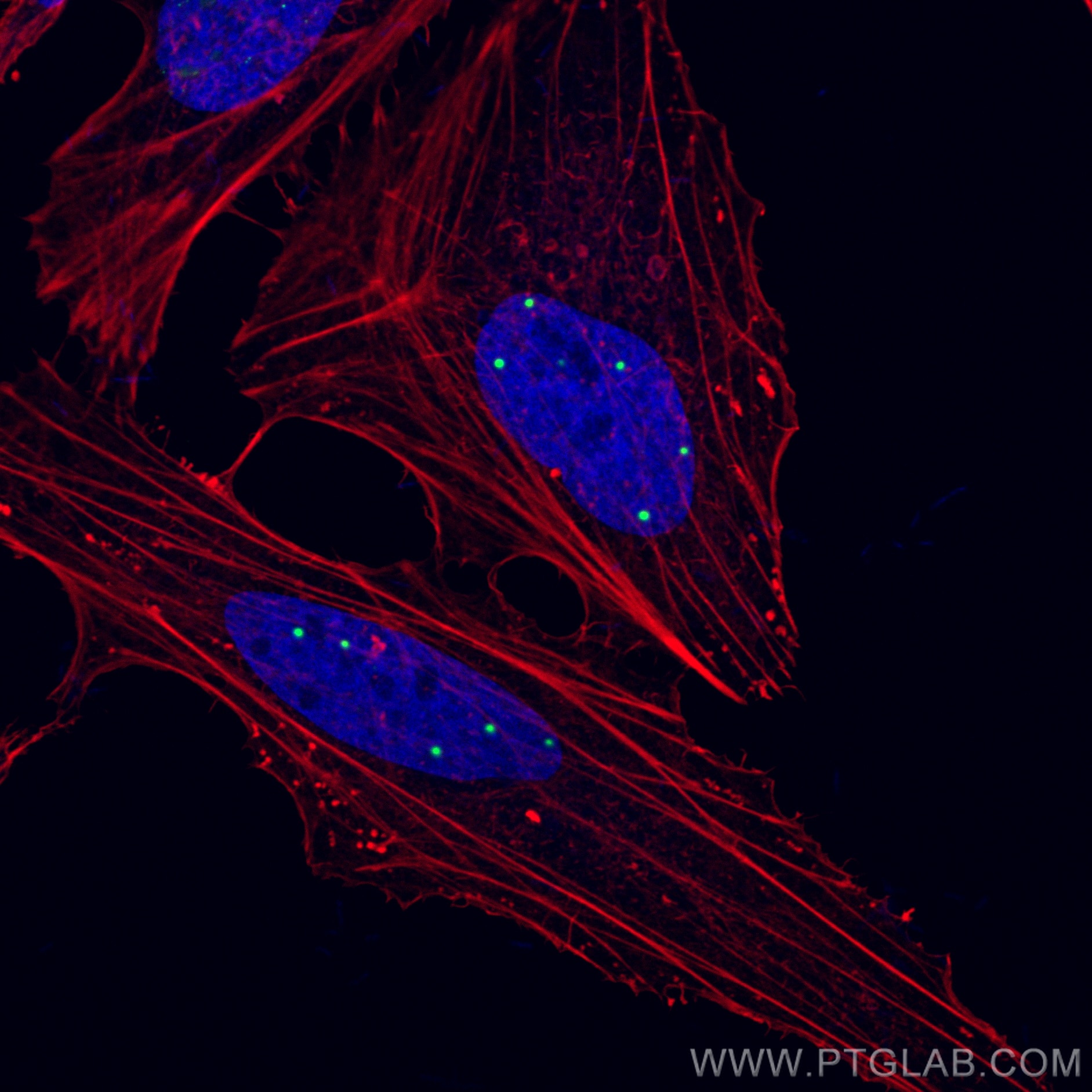 IF Staining of HeLa using 10967-1-AP